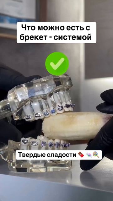 Установка брекетов #стоматологиямосква #доктор #dentist #?
