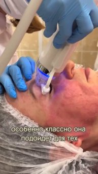 Волшебная палочка для вашей кожи - микроигольчатый RF-л