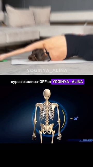 БЕЗОПАСНАЯ ТРЕНИРОВКА ПРИ СКОЛИОЗЕ для не-спортивных,