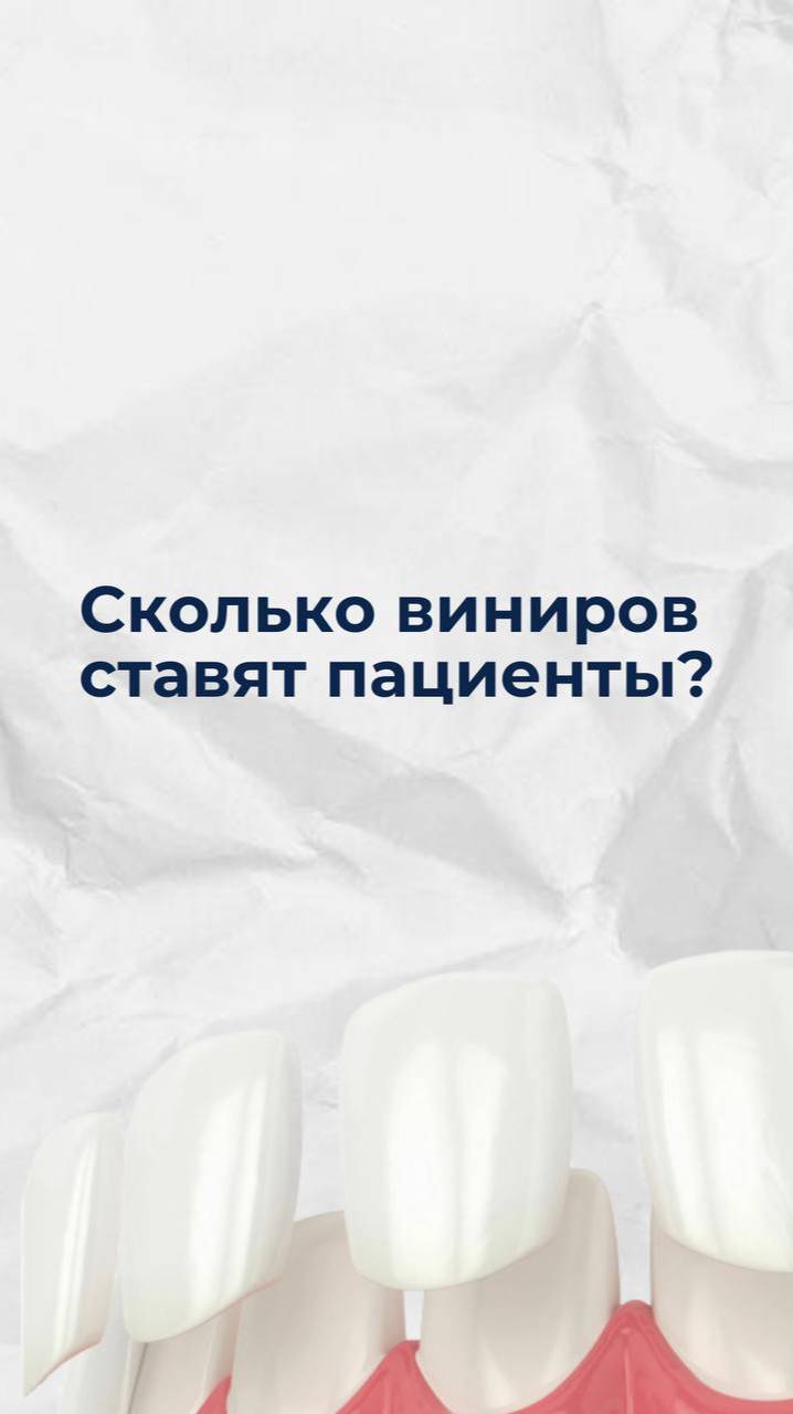 Сколько виниров ставят пациенты