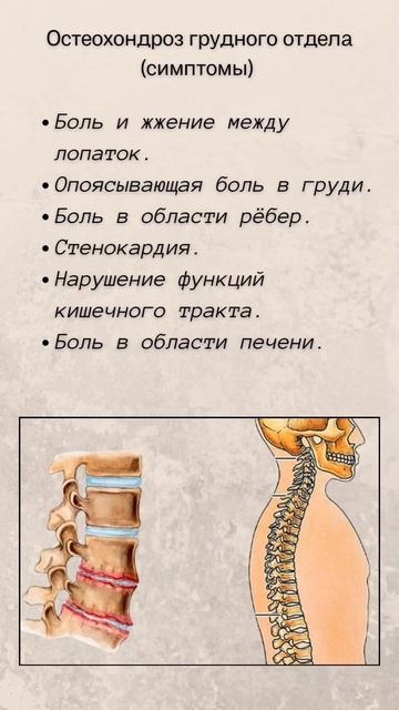 🧑⚕️Остеохондроз? .mp4