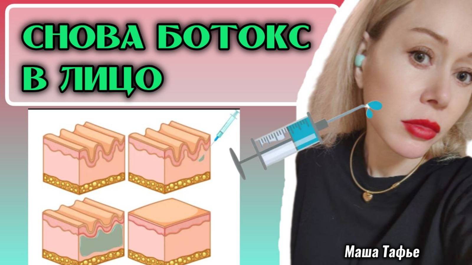 Снова уколола в лицо ботокс. Рассказываю. Весна с Машей 🌷 Видео №75