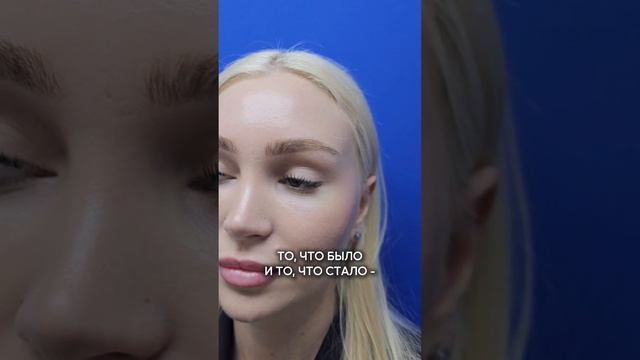 Больше о качественных пластических операциях и преображениях своего тела в моем профиле