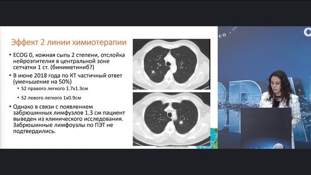 Возможности терапии пациентов с метастатическим КРР с мутацией BRAF. Клинические наблюдения