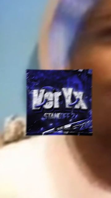 ЭТИ ПРИЦЕЛЫ ПРОСТО ИМБА!