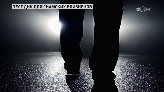 Прямой эфир. ДНК для сиамских близнецов. 04.04.2025