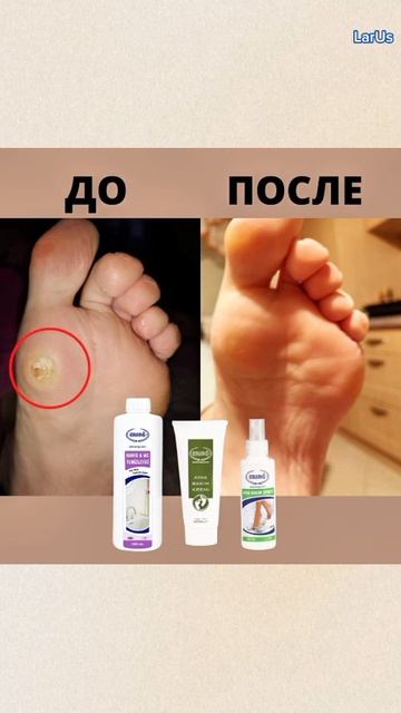 Чудо средство.