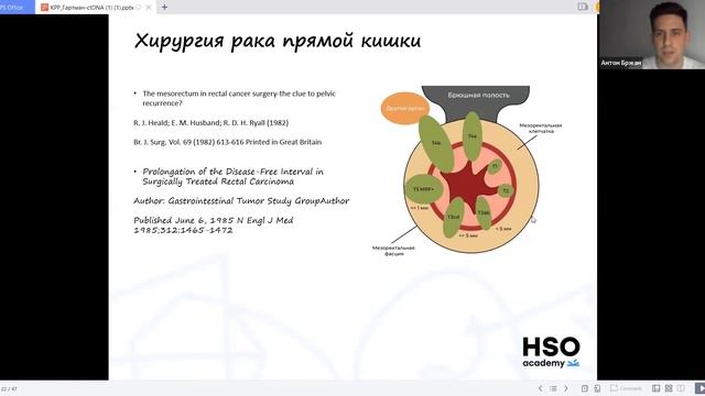 Взлеты, падения и перспективы терапии колоректального рака