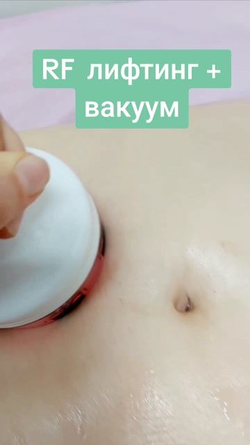 RF лифтинг + вакуум