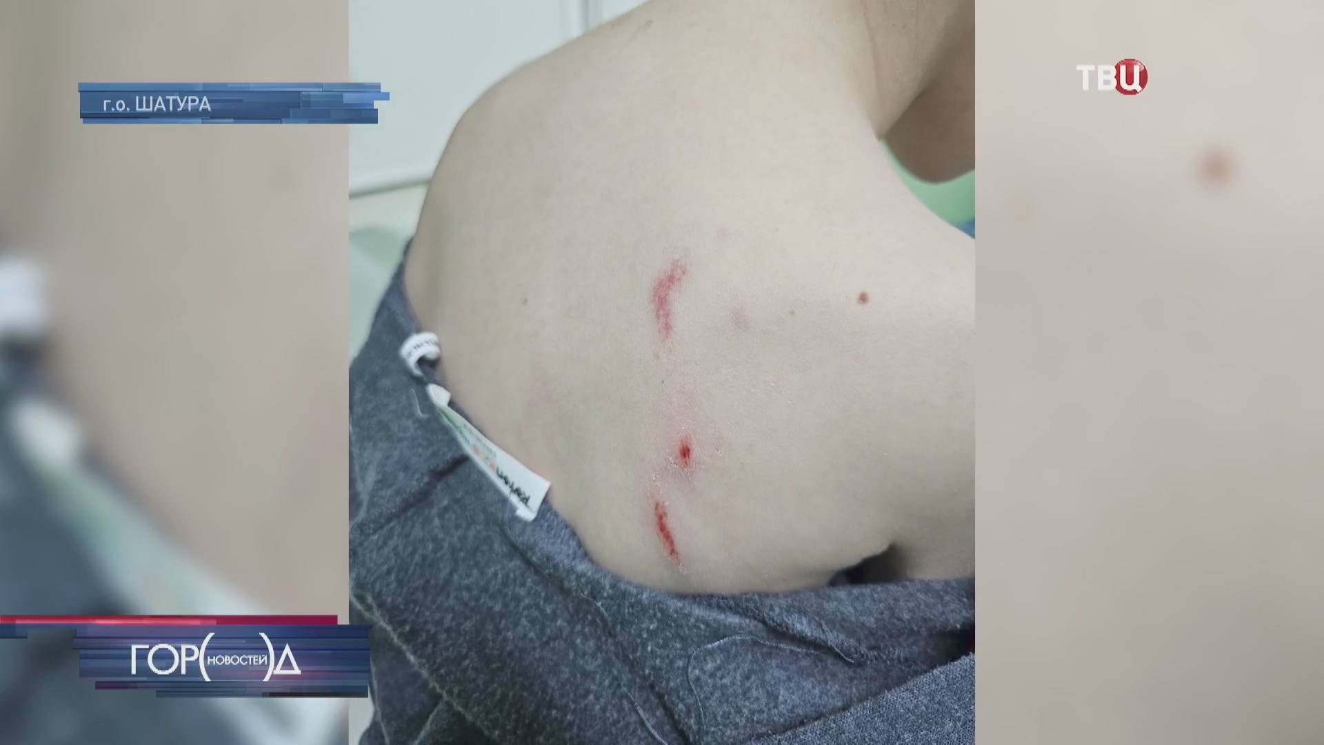 В Подмосковье возбудили дело после нападения алабая на ребенка / Город новостей на ТВЦ