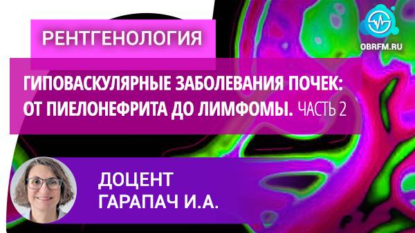 Доцент Гарапач И.А.: Гиповаскулярные заболевания почек: от пиелонефрита до лимфомы. Часть 2
