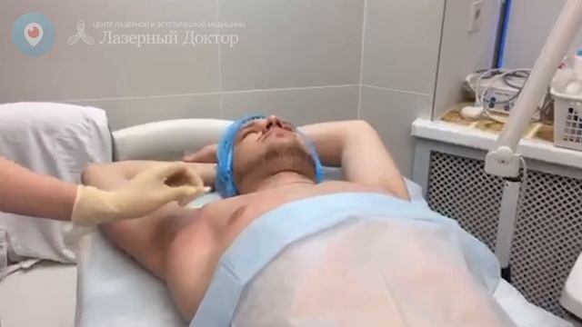 Лечение гипергидроза подмышек - трансляция в Periscope