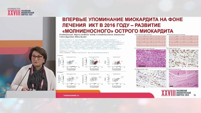 Кардиомиопатия при использовании ИКТИ механизмы развития и клиническое значение