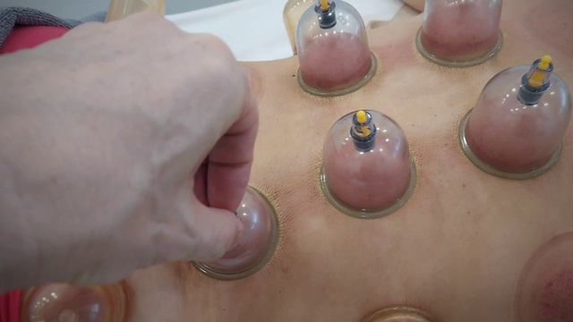 вакуумная коррекция фигуры