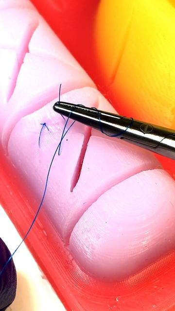 Отличия лапаратомии от лапароскопии | Тренажер Scalpel Med