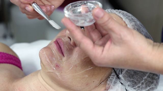 IPL. Эфир. Защита глаз. Без боли