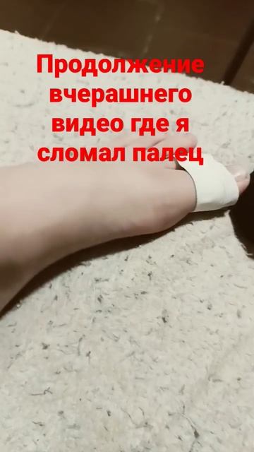 я сломал палец на ноге 2 часть