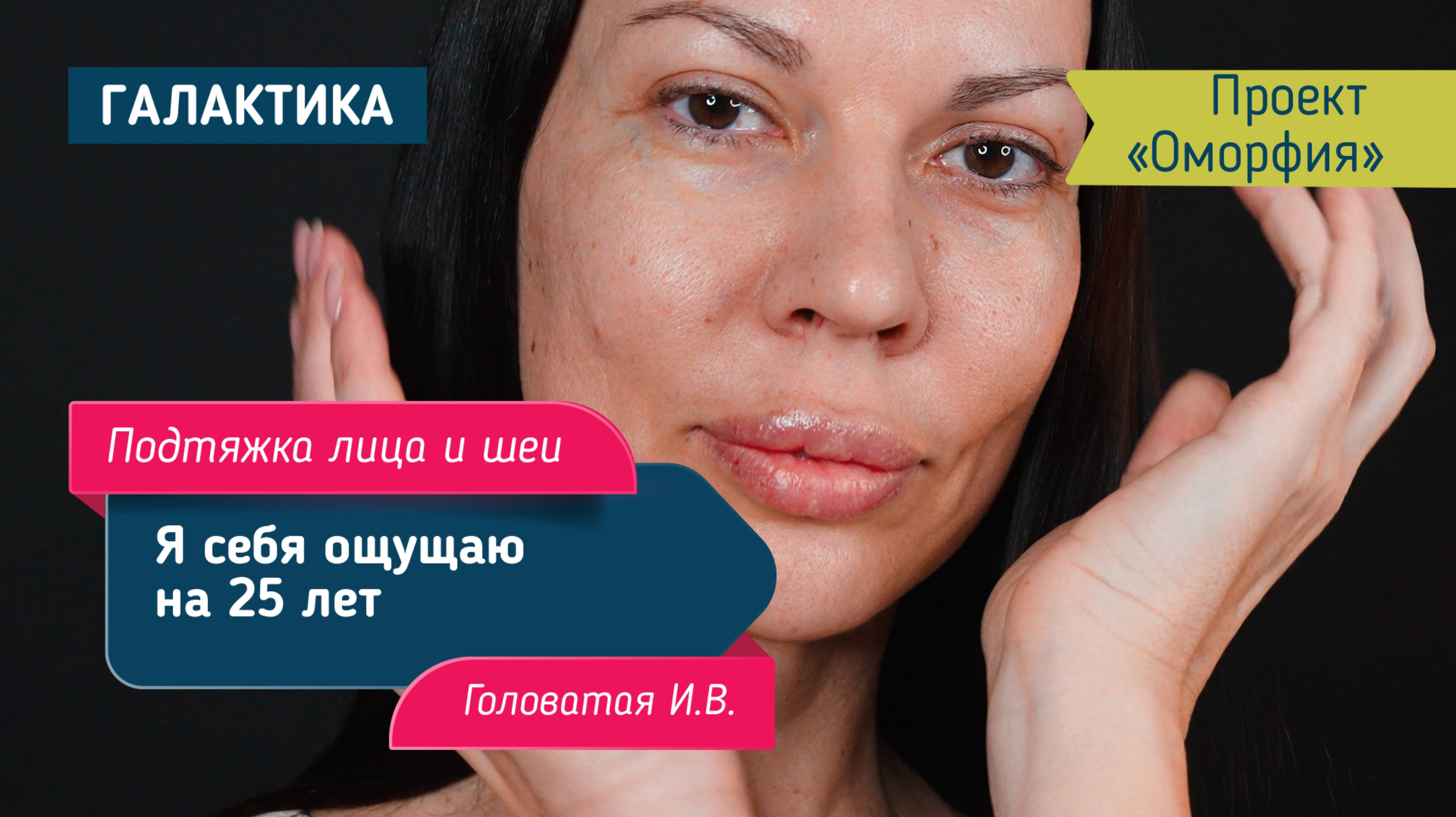Проект "Оморфия" эндоскопическая подтяжка нижней трети лица и шеи | Головатая Ирина Вячеславовна