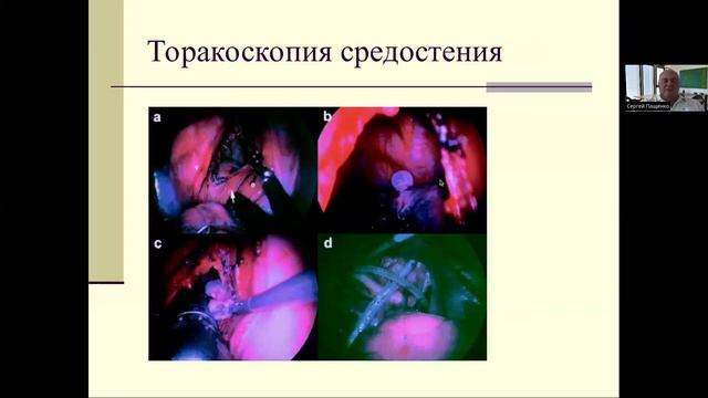 Диагностика рака Скриннинг в онкологии  Часть 3