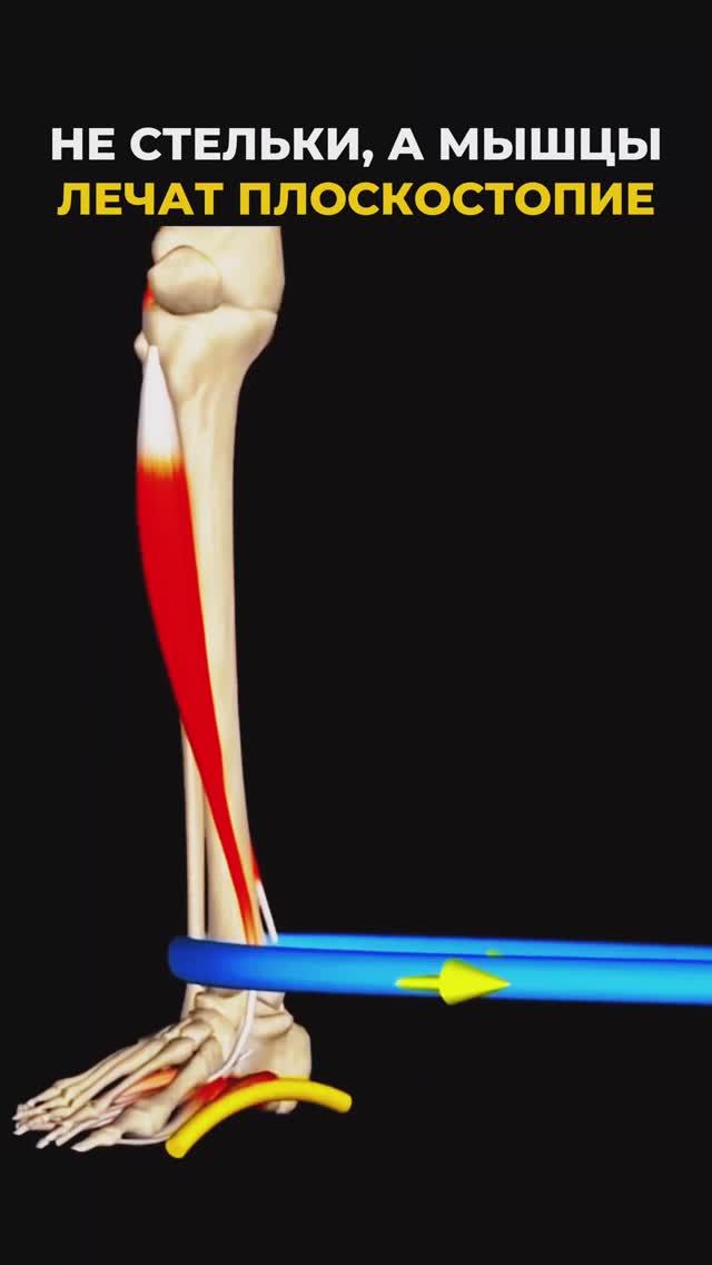 Избавься от плоскостопия. Подпишись и читай описание ✅