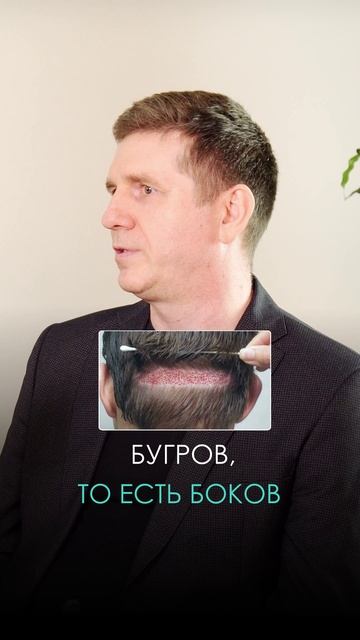 Откуда берут волосы для пересадки волос? Донорская область при трансплантации