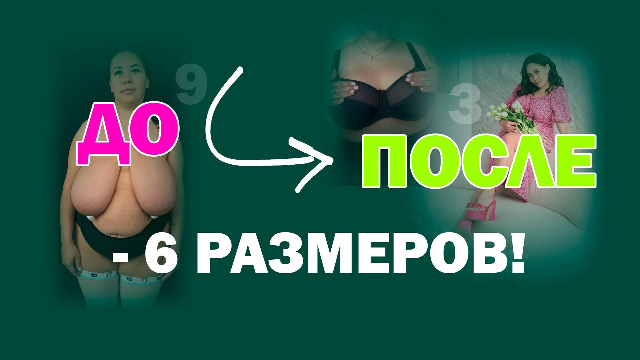 Редукционная маммопластика: что важно знать до операции — рассказывает хирург и пациентка
