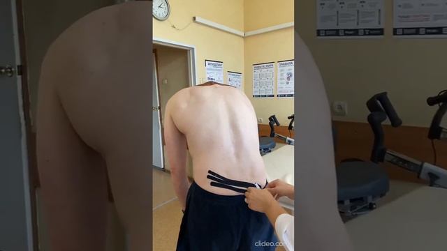 Кинезиотейпирование 2