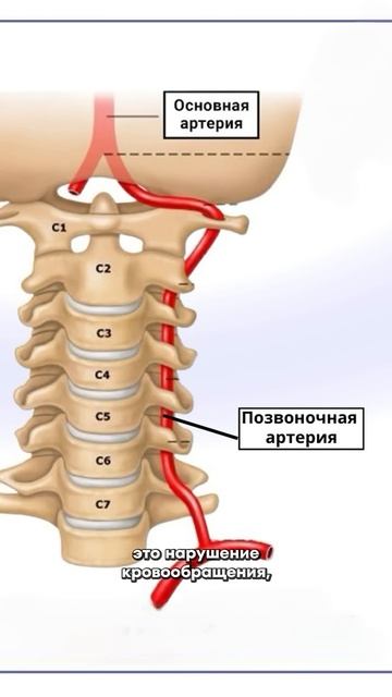 Причины шума в ушах. Упражнения при шуме в ушах. #ладание