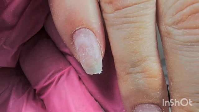 Маникюр на сложных руках,перепиленные точки вроста,палки заусенцы#nails#дизайнногтей #маникюр#ногти