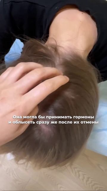 КОГДА АЛОПЕЦИЯ УТРАИВАЕТ СИЛЫ: ПОБЕДА БЕЗ ХИМИИ И СКАЛЬПЕЛЯ | Метод НеТЛАП