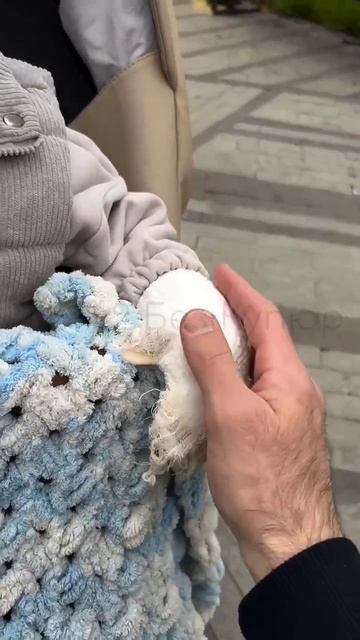 Весь в бинтах: Тигран Салибеков показал сына после экстренной пересадки кожи
