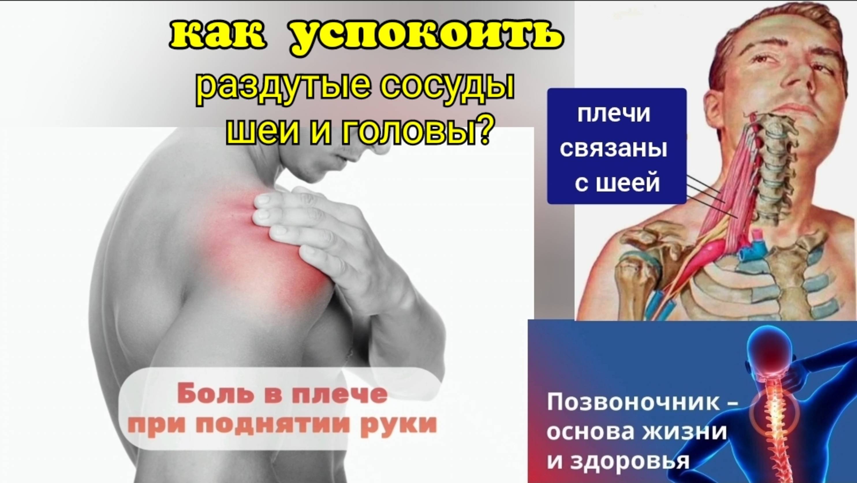 Главные артерии шеи и мозга деградируют по вине дельтовидных мышц. Укрепляем плечевые суставы