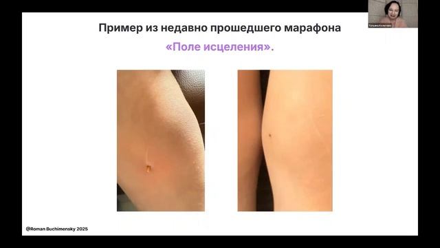 Поле исцеления работает без сомнения ! Случай Анастасии