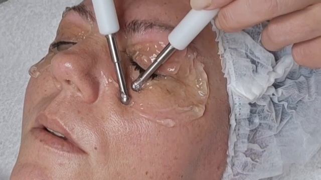 Стимуляция мышц области глаз. Лифтинг век !!