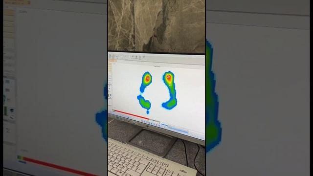 Ортопедические стельки PEDCAD в Ташкенте.