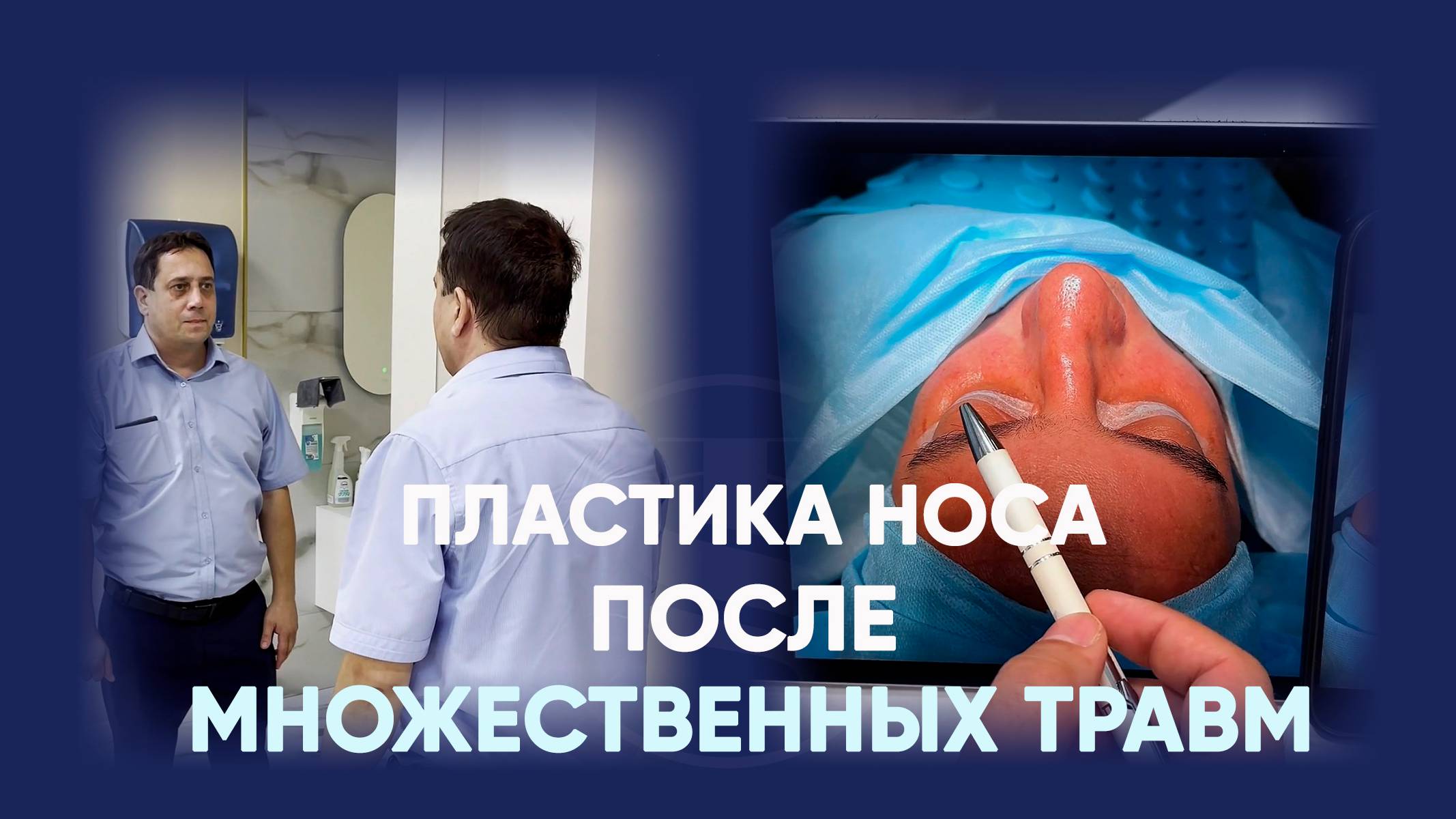 Нос после травм: результат риносептопластики через 2 недели