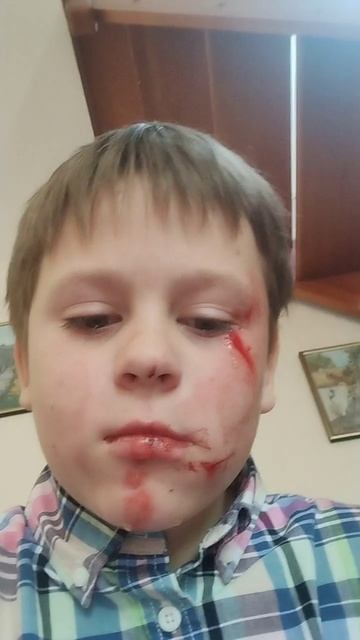 я в больнице