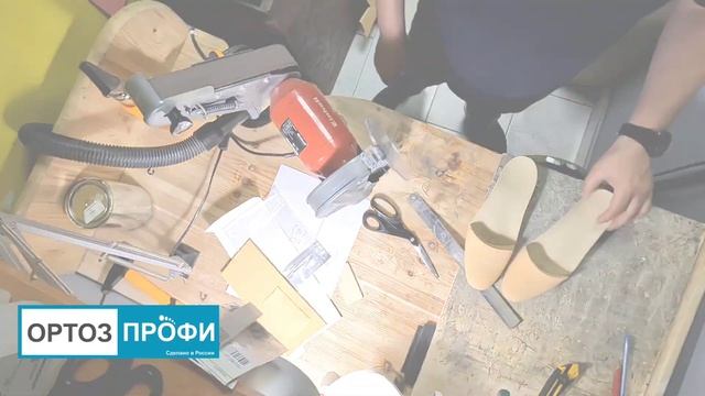 Изготовление стелек при ампутации стоп по Лисфранку