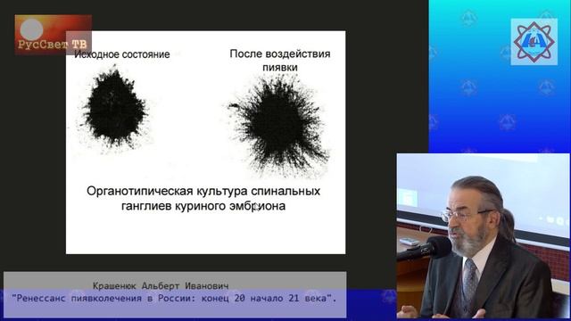 Крашенюк Альберт Иванович «Ренессанс пиявколечения в России - конец XX - начало XXI века».