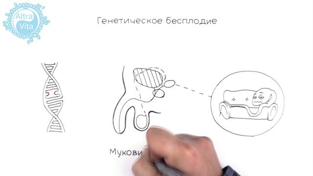 Мужское бесплодие. Просто о сложном.