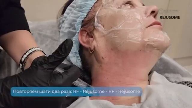 Экзосомы в косметологии - препараты Rejusome и RF лифтинг