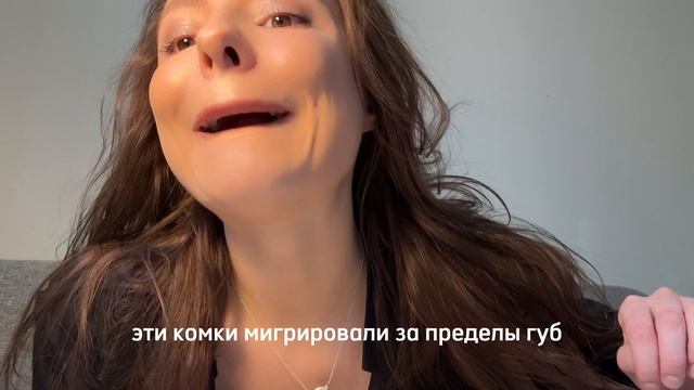 Жертва красоты или Как мне испортили губы в салоне! Подробности в ТГ: Aleksandrova_life