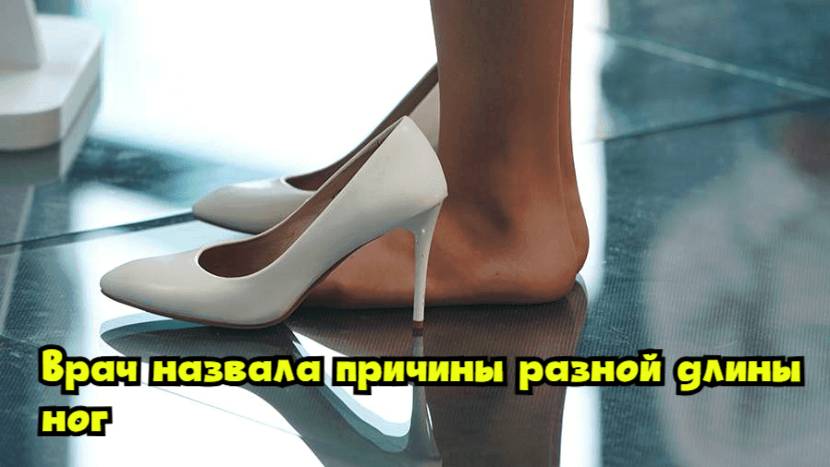 Врач назвала причины разной длины ног