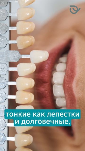 Виниры