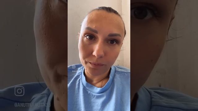 Ура!!! Проблем прибавилось! Будем лечиться 😂 #чихуа #шпиц