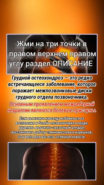 МЕЖРЕБЕРНАЯ НЕАВРАЛГИЯ