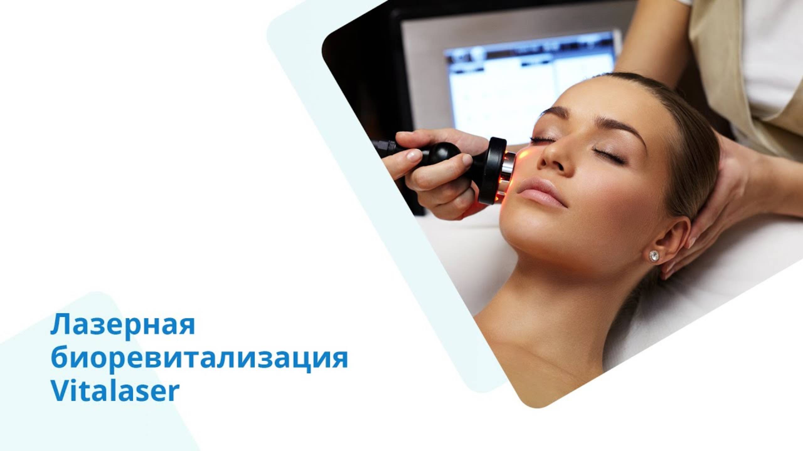 Безынъекционная биоревитализация в клинике DemoStom