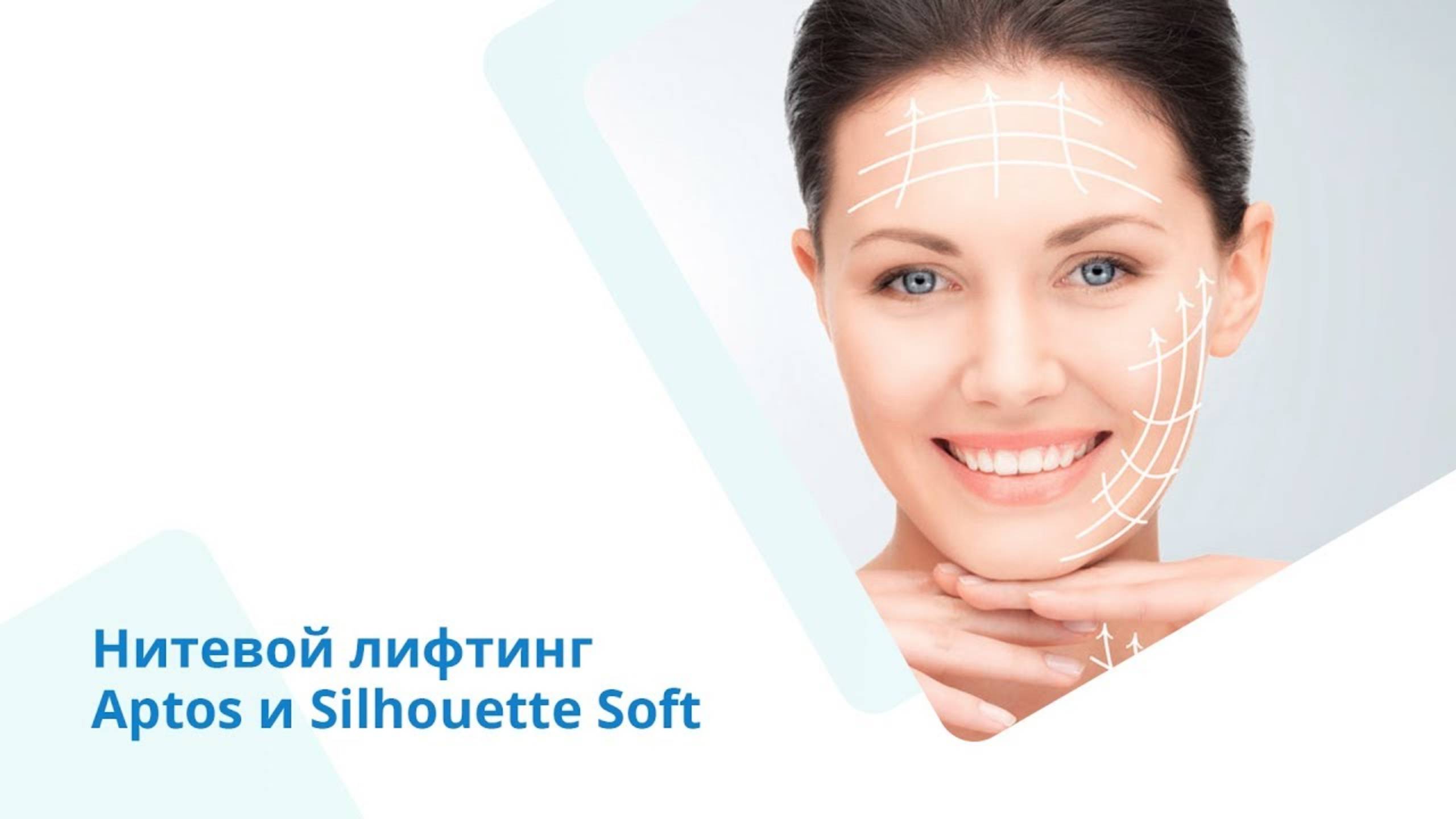 Нитевой лифтинг Silhouette Soft и Aptos