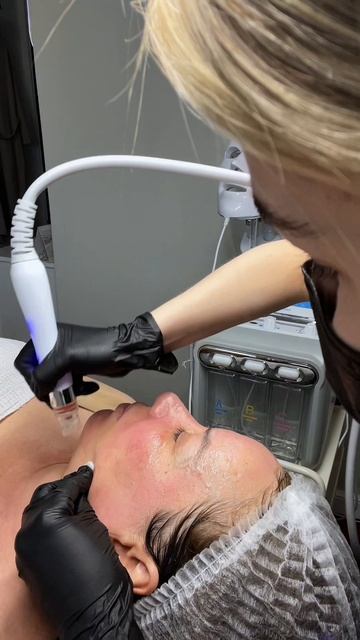 Вакуумный гидропилинг  Hydro facial