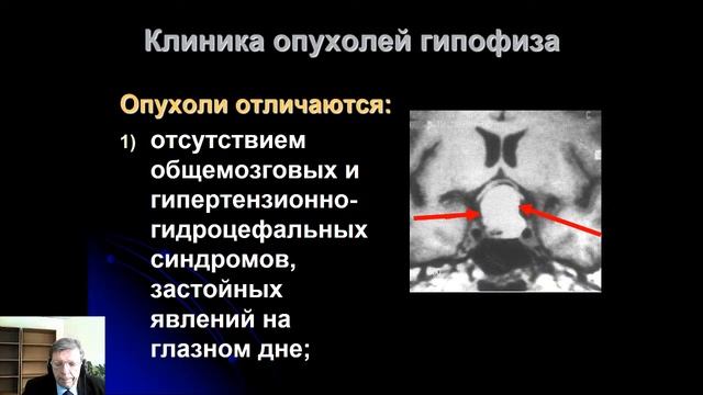 II 12. Опухоли головного мозга